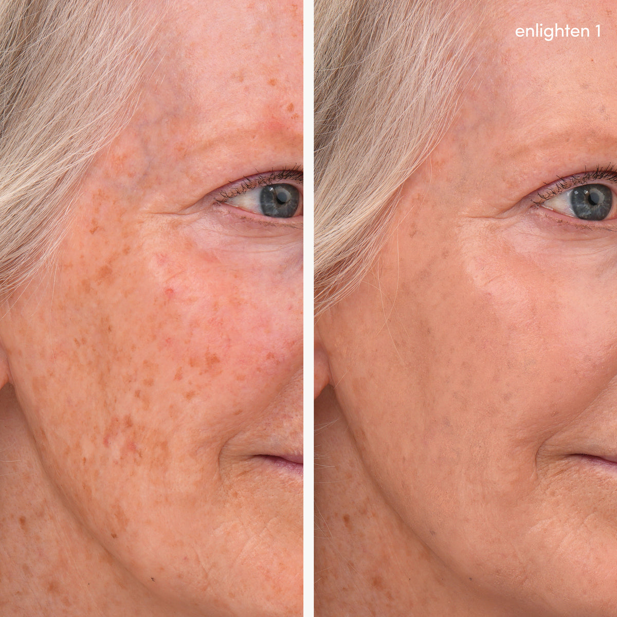 Enlighten Concealer™