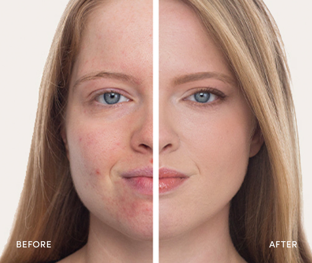 Get your best skin yet